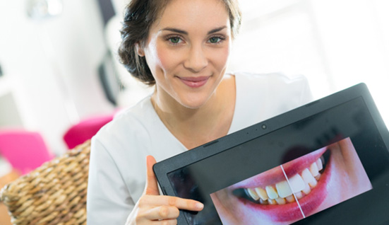 Woman showing a before/after picture of someone’s smile
