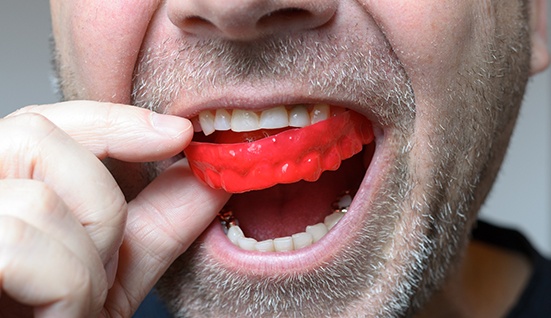 Nose-to-chin close-up of man inserting red mouthguard over top arch