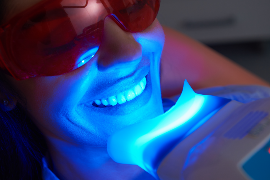 Woman undergoing dental whitening treatment