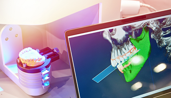 Machine in a dental lab creating a denture based on an impression of a patients teeth on a nearby screen