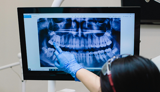 Dentist pointing to a screen showing a patients x rays of their teeth